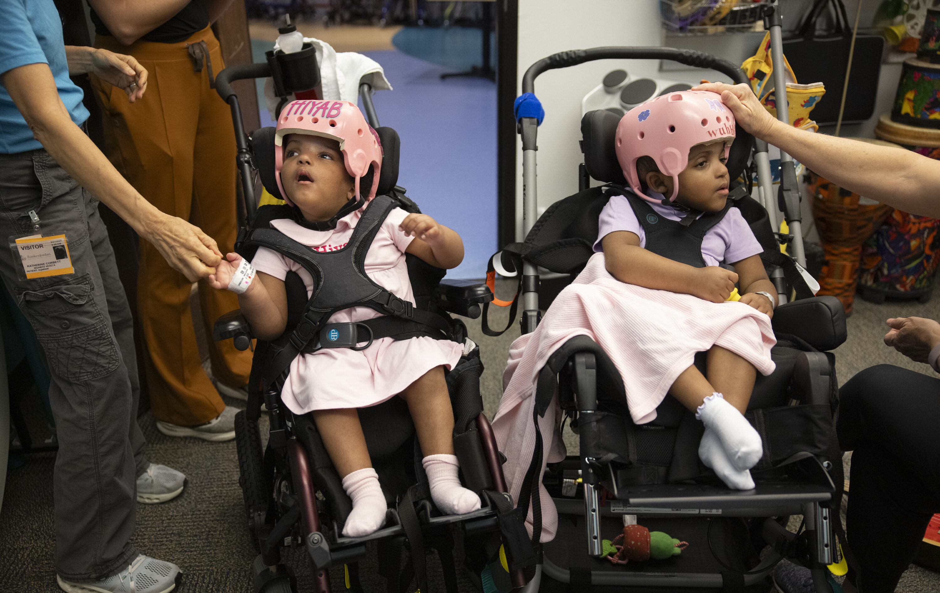 Cardinal Glennon Children’s Hospital succesfully separates twins conjoined at the head